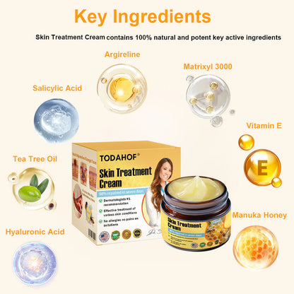 ✅Official Store TF02: 7-Day Multi-Effect All-in-One Skincare Cream (👨‍⚕️AAD Recommended🌼)Psoriasis (fast itch relief and skin repair)