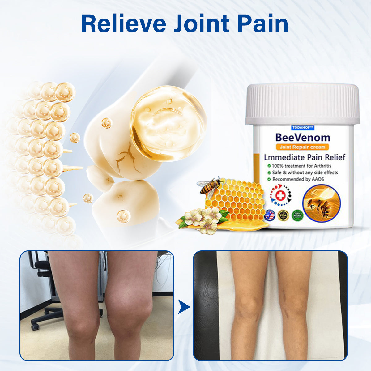 ✅Official Store 866: TODAHOF® BeeVenom Joint Repair Cream👨‍⚕️ Effective treatment of Arthritis (pain, swelling, deformity, stiffness, weakness)