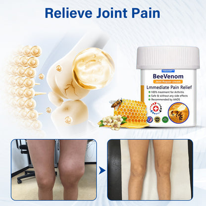 ✅Official Store 866: TODAHOF® BeeVenom Joint Repair Cream👨‍⚕️ Effective treatment of Arthritis (pain, swelling, deformity, stiffness, weakness)