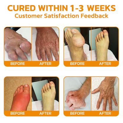 ✅Official Store 866: TODAHOF® BeeVenom Joint Repair Cream👨‍⚕️ Effective treatment of Arthritis (pain, swelling, deformity, stiffness, weakness)